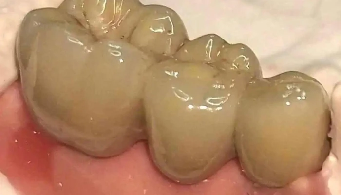 Pizerchio Odontologia -  Tudo - Valença